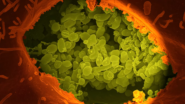 Researchers Develop Antibacterial Polymers that Kill Superbugs